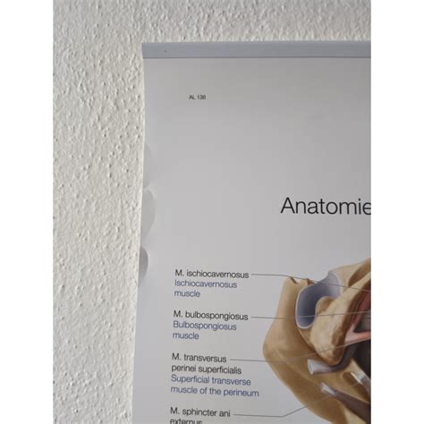 Schéma lokalizácie endometriózy v panve