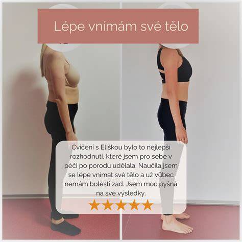 obrázok 1 - diastáza a zápis rozostupu