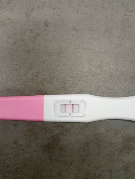 Kedy ísť ku gynekológovi po zistení tehotenstva a čo očakávať na prvej návšteve