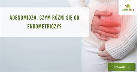 endometrioza-adenomioza-razdiely-symptomy