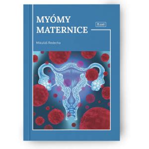 myomy-maternice-terapia
