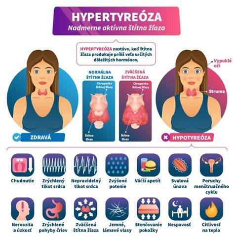 Infografika: Štítna žľaza a tehotenstvo - ako funguje