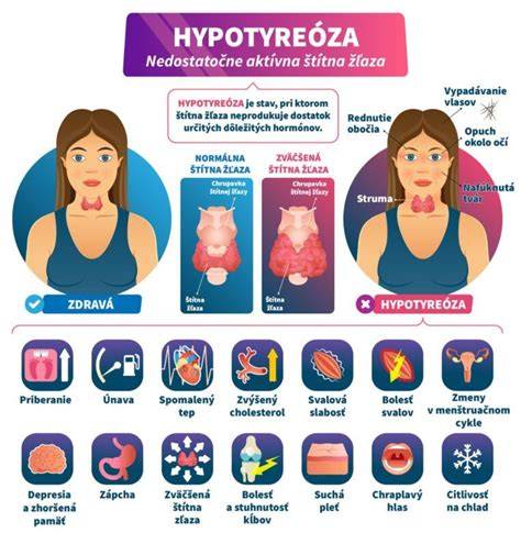 Odstránenie štítnej žľazy a tehotenstvo: riziká a odporúčania
