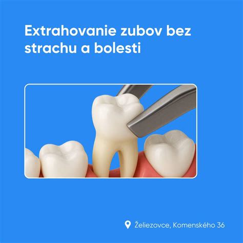 Vytrhnutie zuba: Komplikácie a starostlivosť po zákroku