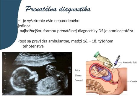 schéma prenatálnej diagnostiky