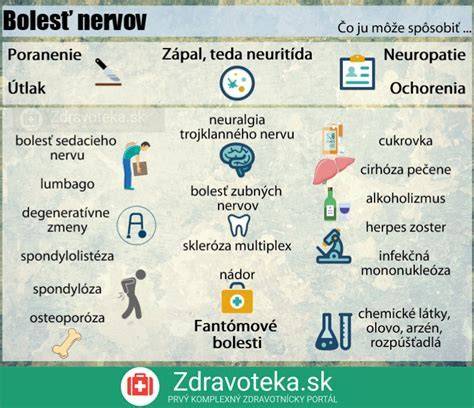 Infografika: anatomia plexus solaris a možné miesta bolesti počas tehotenstva