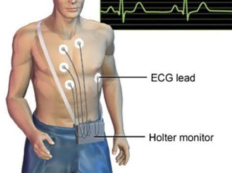 Diagnostické postupy pri palpitáciách: EKG, Holter, Echo