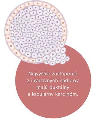 Infografika: Schéma hormonálnych receptorov v bunkách karcinómu prsníka a cieľov hormonálnej liečby