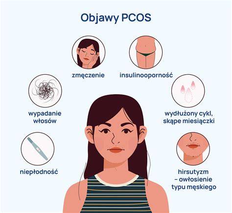Infografika: PCOS a jeho vplyv na plodnosť, inzulínovú rezistenciu a hormonálnu nerovnováhu