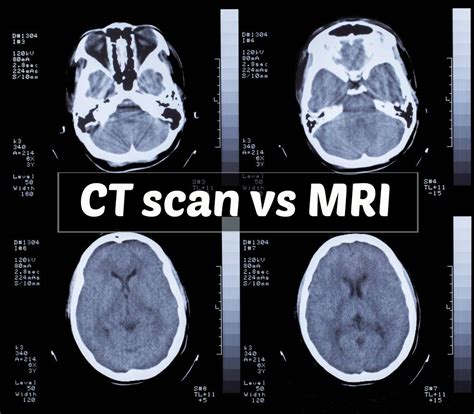 Infografika: MRI vs. röntgen a CT - bezpečnostné rozdiely v tehotenstve
