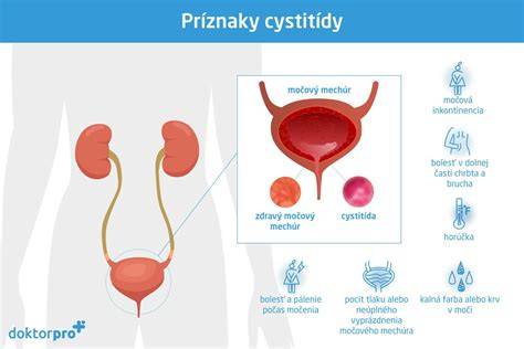 Obrázok: prehľad anatomických zmien močového traktu počas tehotenstva