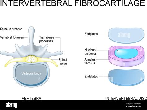 Infografika: anatomy_of_intervertebral_discs_and_hernia