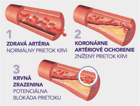 Schéma prietoku krvi v panvovej oblasti