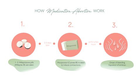 Infografika: Ako funguje lekársky potrat (mifepristón a misoprostol) a časový harmonogram