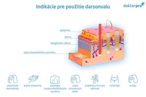 Infografika zobrazujúca rôzne indikácie pre použitie prometazínu
