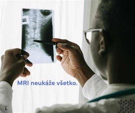 ikonická ilustrácia: čo treba vedieť o RTG počas dojčenia