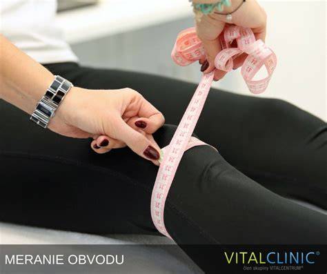 Obrázok ukazujúci správne meranie obvodu hlavy dieťaťa a rozloženie očiek na ihliciach
