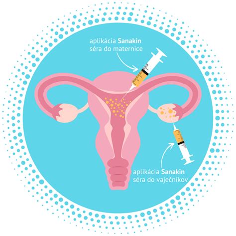 Alchemilka a jej úloha pri príprave na IVF a podpore plodnosti