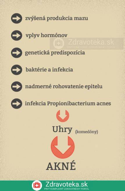 Infografika: Mechanizmus vzniku komedónov a hlavné faktory