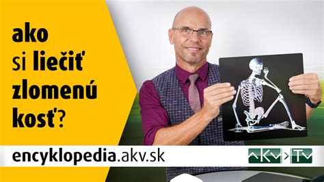 Diéta pri trieštivej zlomenine kosti: Prehľad výživy a liečby pre optimálne hojenie