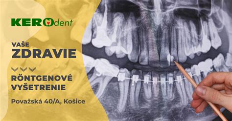 Schéma zobrazujúca zubný röntgen a jeho účel