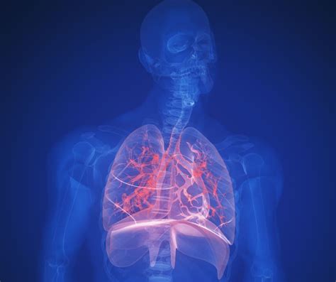 Rozšírená aorta u novorodencov: Príčiny, diagnostika a liečba