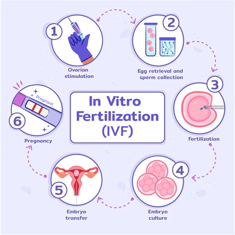 Infografika: priebeh IVF