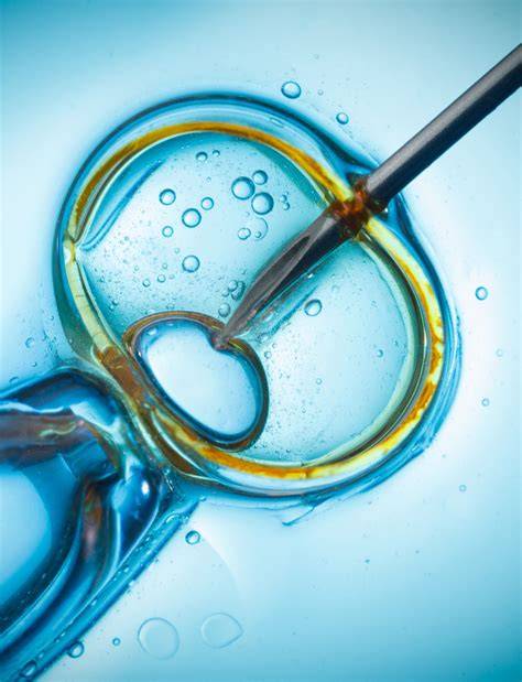 Priebeh a metódy umelej oplodnenia IVF: prehľad krokov, techník a súvisiacich tém