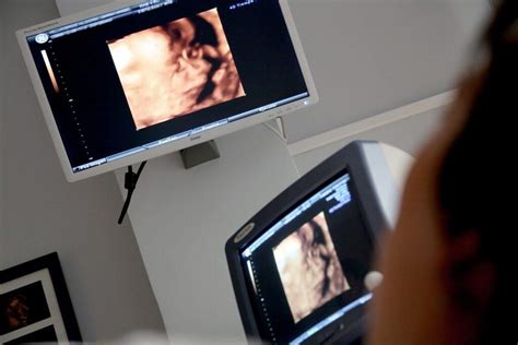 Ako otehotnieť: Pochopenie plodných dní a cyklu