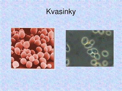 Štruktúra kvasinky Malassezia