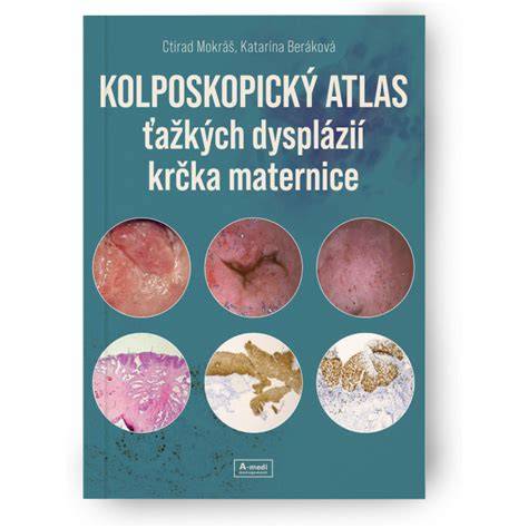 Postup intervencie: dilatácia krčka, odsatie a kyretáž