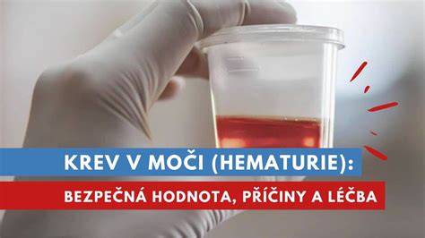 Obrázok schémy hCG a jeho časový priebeh v krvi a moči