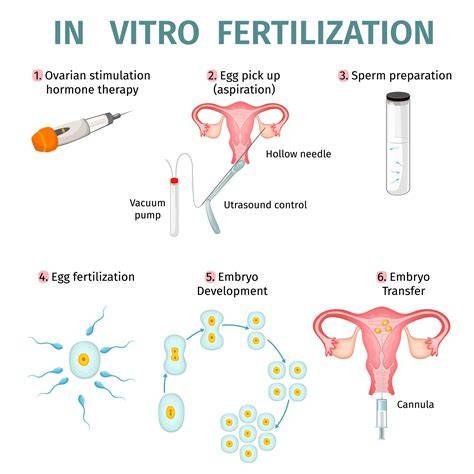 Diagram: IVF a darované vajíčka - scenáre podľa veku