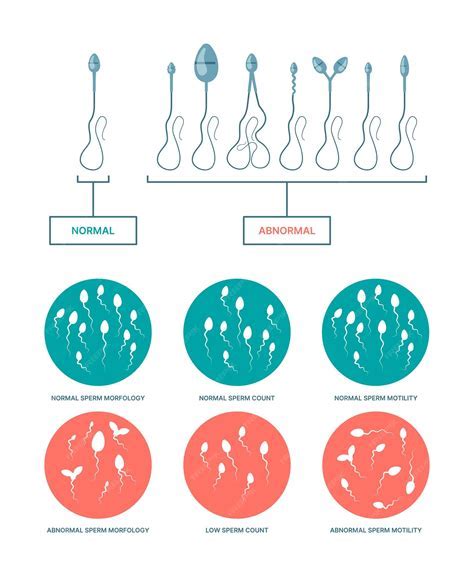 Infografika: Ako funguje plodné okno a prežitie spermií