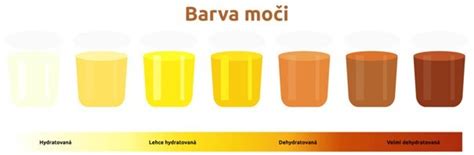Grafika zobrazujúca rôzne farby soplíkov a ich možné príčiny