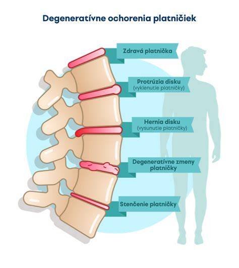 Schéma diagnostiky a liečby habituálnych potratov