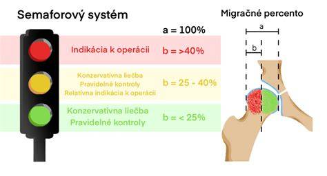 Infografika: Trojitý sit a harmonogram vyšetrení bedrových kĺbov
