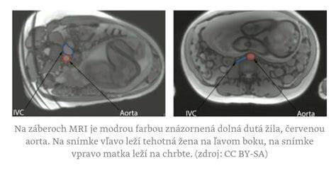 Infografika: Priebeh druhého trimestra ultrazvukov a testov