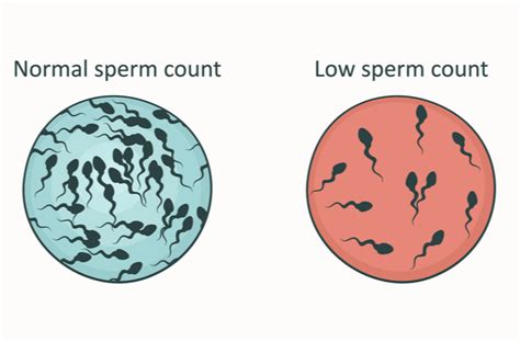 Infografika: Bežné príčiny mužskej neplodnosti a diagnostické kroky