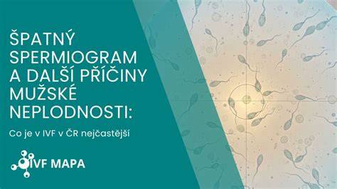 Mapa: Základné pravidlá a percentuálne pokrytie IVF v Európe