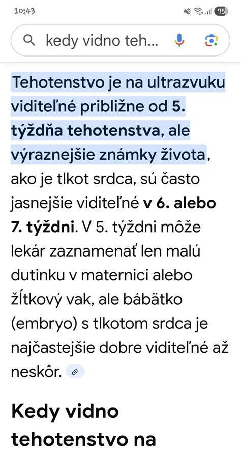 Kedy je viditeľné srdce plodu na ultrazvuku a ako ho počuť