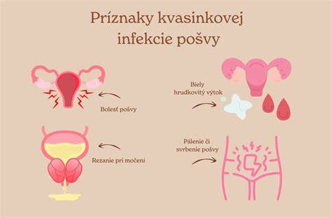 Typy vaginálneho výtoku a ich možné príčiny: BV, kvasinková infekcia, Trichomonas