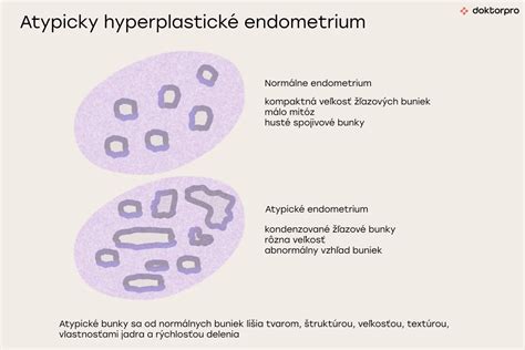 Hyperplázia endometria: príznaky, diagnostika a liečba so zameraním na vzhľad maternice