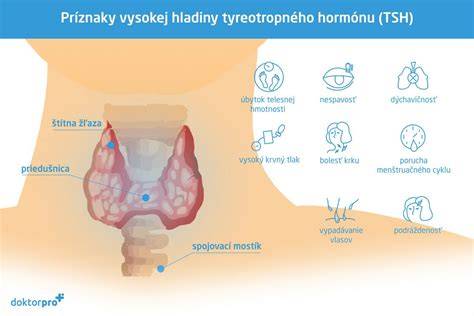 Hyperfunkcia štítnej žľazy v tehotenstve: príznaky, liečba a riziká