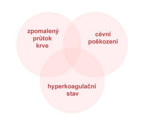 Infografika: Virchowova triáda a mechanizmus PE