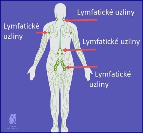 Anatomické umiestnenie lymfatických uzlín v ľudskom tele