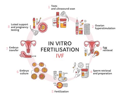 Schematické znázornenie IVF