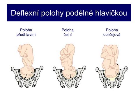 Rôzne polohy plodu počas pôrodu