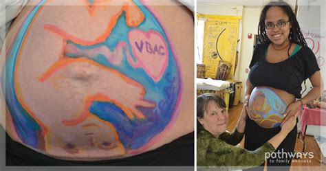 Ilustrácia metódy Belly Mapping
