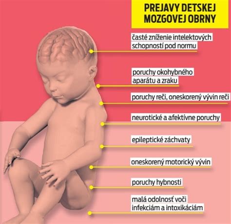 Typy detskej mozgovej obrny